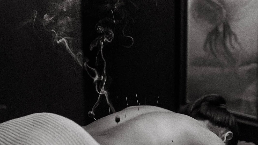 Acupuncture treatment plan