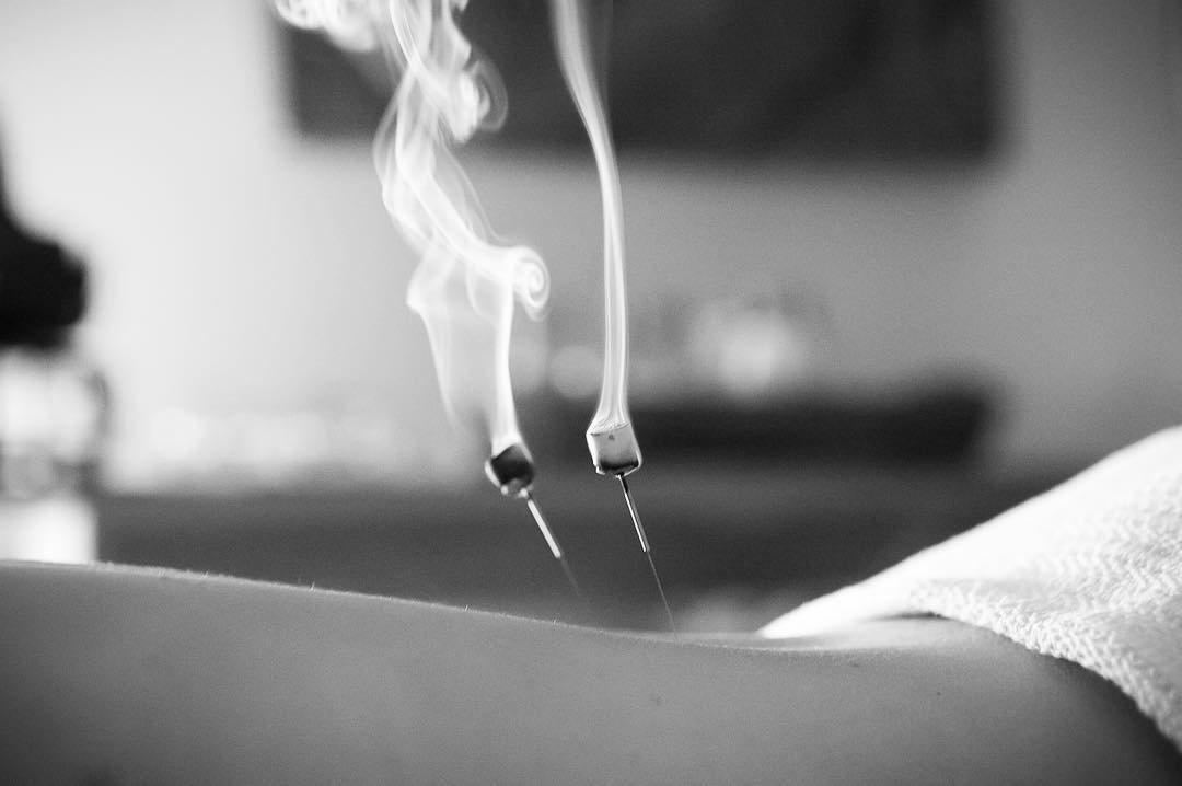 Needlehead moxa cones with smoke